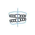 Cirugía Ortognatica