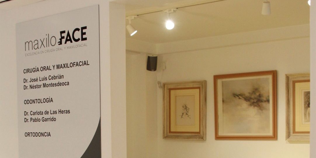 En Maxiloface valoramos su caso