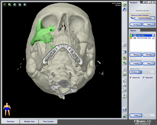 Planificación 3D reconstrucción órbita